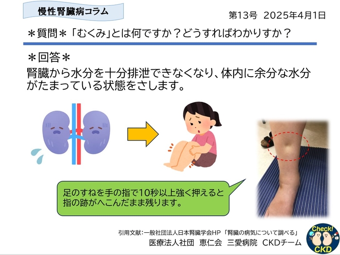 CKDについてもっと知ろう