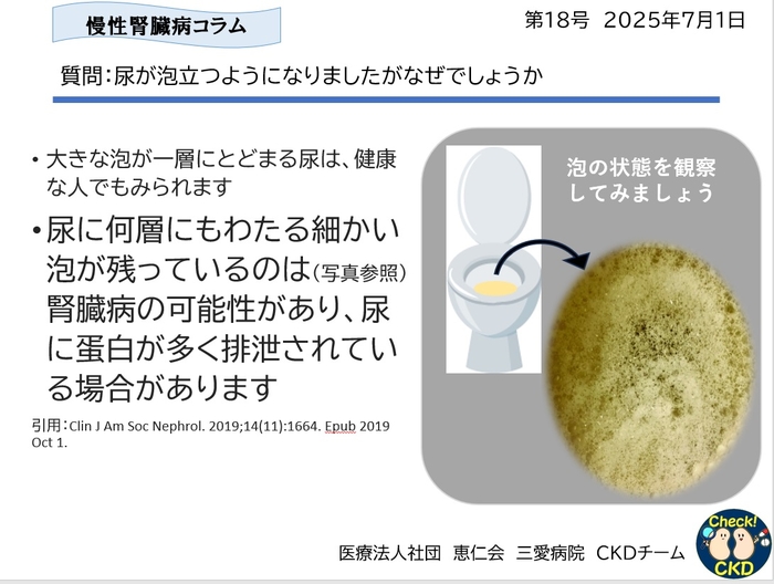 CKDについてもっと知ろう