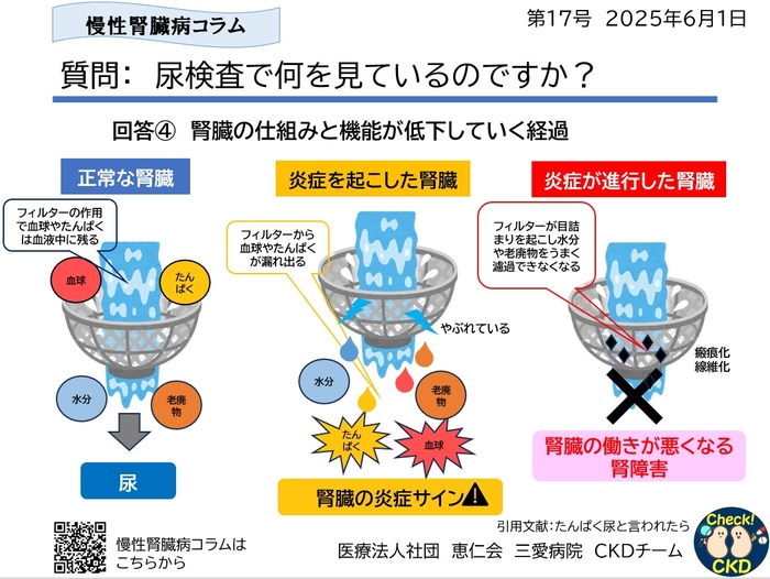 CKDについてもっと知ろう